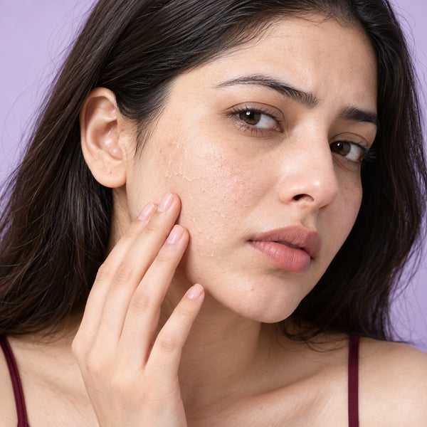 Dry Skin