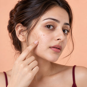 Spots Reduction