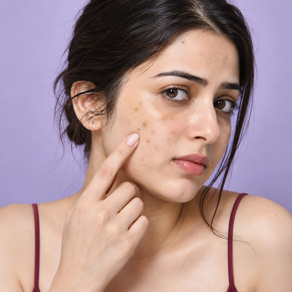 Dark Spots
